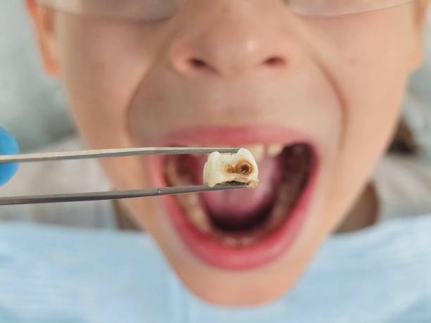 Best Emergency Gum Pain Relief  in Burgaw, NC